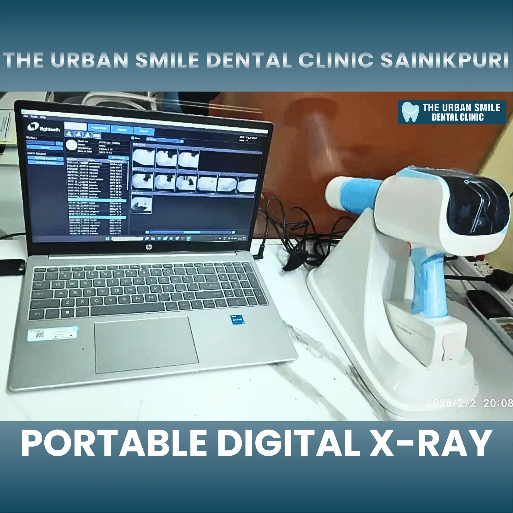 Portable Digital X-Ray System